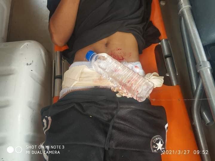 LaPyae77831553's tweet photo. Tw // blood
On Mar 27, Meikhtila also got violently dispersed by Junta's licensed terrorists that three people got injured with the gunshots' wounds at thigh, pubis and another ones' unknown yet. 
#WhatsHappeningInMyanmar 
#Mar27Coup https://t.co/5XHYBQm2QB