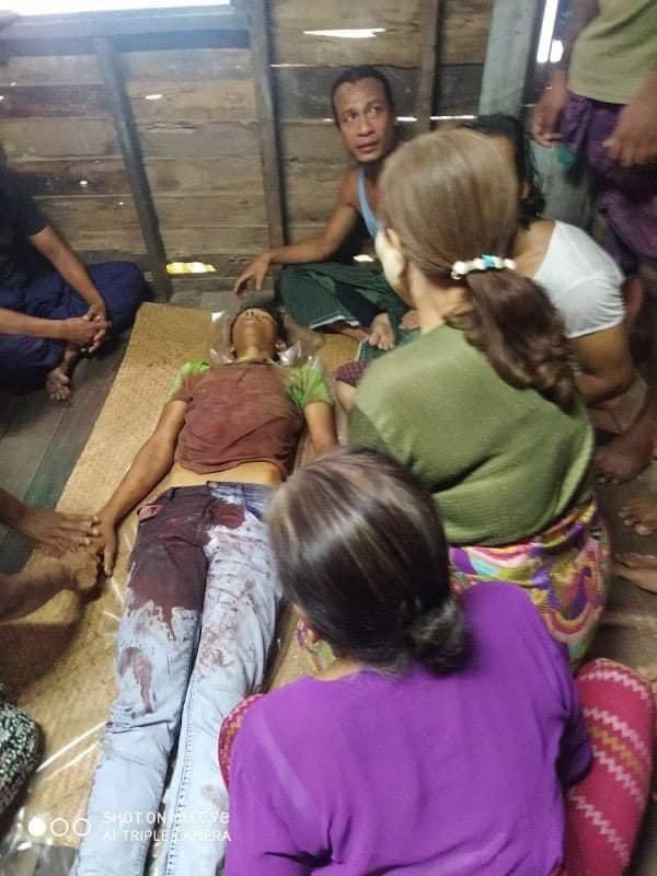 A sixteen-year old boy died today because he went out and raised his voice on the brutality of the military government. This is what happens when u raise your voice. 

#WhatsHappeningInMyanmar 
#Mar27Coup 
#SaveMyammar