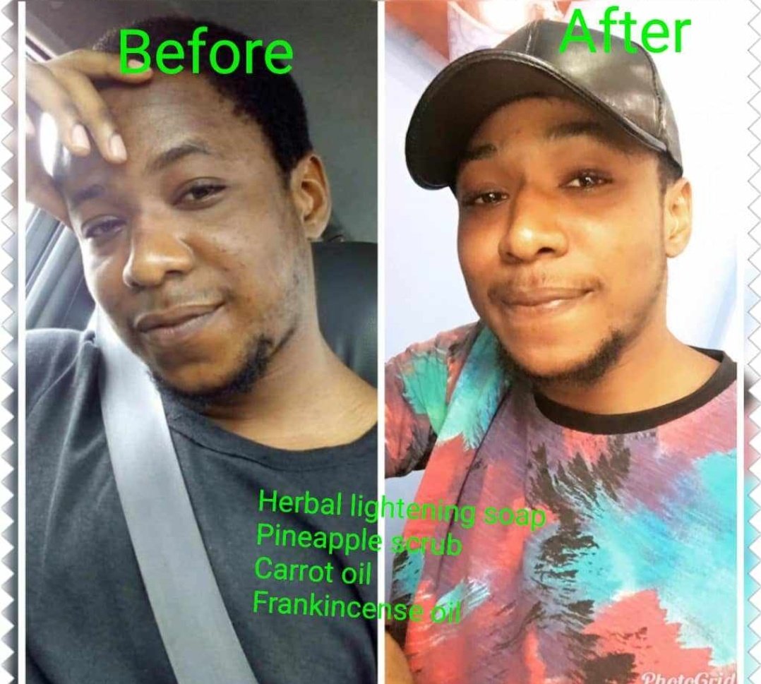 BDEssential's tweet photo. With Avilanaturalle, your glow comes naturally..
When your skin is well taken care of and looks good, You will feel more confident in it..
Have a pleasant weekend everyone 😊

For more enquiries send a DM
WhatsApp or call 08092571650
We care you glow https://t.co/RnkxW6L9Zl