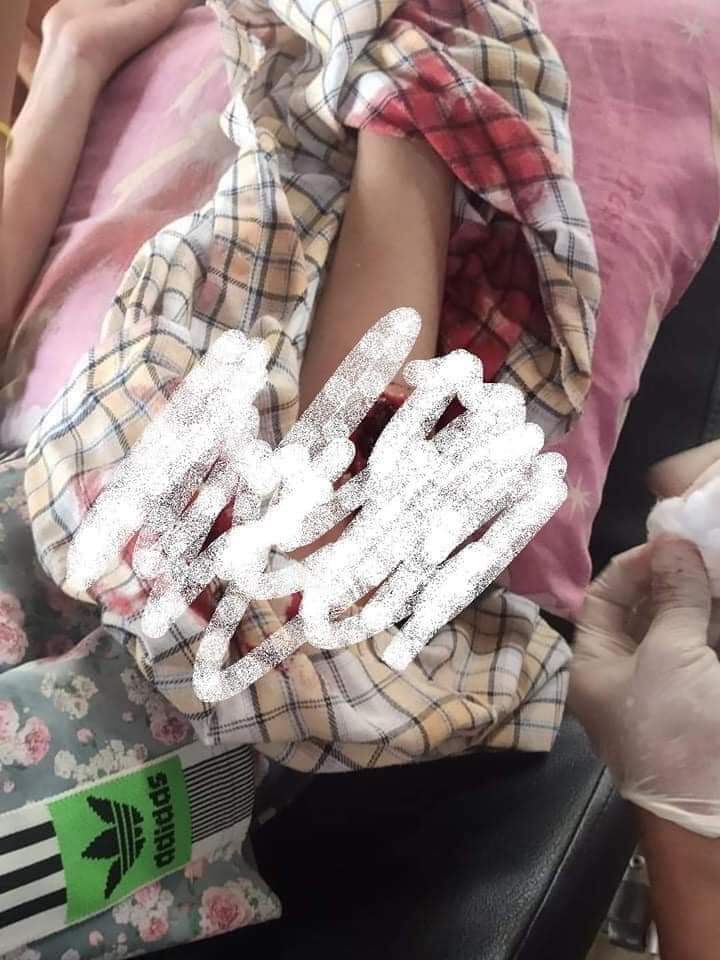 MerriesMay's tweet photo. Tw // blood 
Happening in KyikeHto; 1st Death on Mar 27 in KyikeHto township was shot in head n the other three who got shot were in critical conditions.
ANTIFASCIST REVOLUTION
#AntiFascistRevolution2021
#Mar27Coup
#WhatsHappeningInMyanmar
@USEmbassyBurma @UN_HRC @UNinMyanmar https://t.co/2y0nAeTvWi