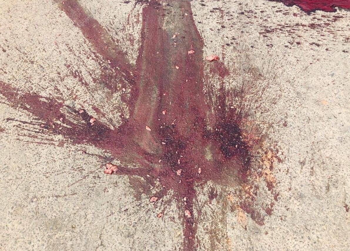 Jiyunnne's tweet photo. tw // blood
A man got headshot by military junta terrorists in PyinOoLwin. His brain tissues are seen spread on the ground.
ANTIFASCIST REVOLUTION
#AntiFascistRevolution2021
#Mar27Coup
#WhatsHappeningInMyanmar https://t.co/yYNapMBF0x
