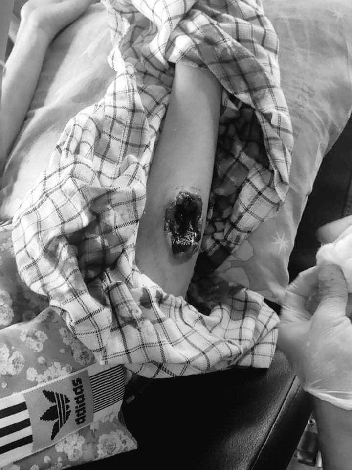 Pencilo4's tweet photo. tw // wound // blood
A civilian was shot dead in the head and the body was taken away in #Kyaikto, Mon state. At least 6 people were shot with live bullets including a reporter on the ground.
ANTIFASCIST REVOLUTION
#AntiFascistRevolution2021
#Mar27Coup
#WhatsHappeningInMyanmar https://t.co/11tPFqApCt