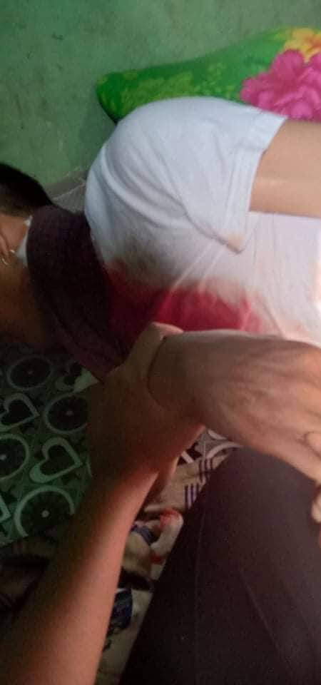 tw // wound // blood
A civilian was shot dead in the head and the body was taken away in #Kyaikto, Mon state. At least 6 people were shot with live bullets including a reporter on the ground.
ANTIFASCIST REVOLUTION
#AntiFascistRevolution2021
#Mar27Coup
#WhatsHappeningInMyanmar