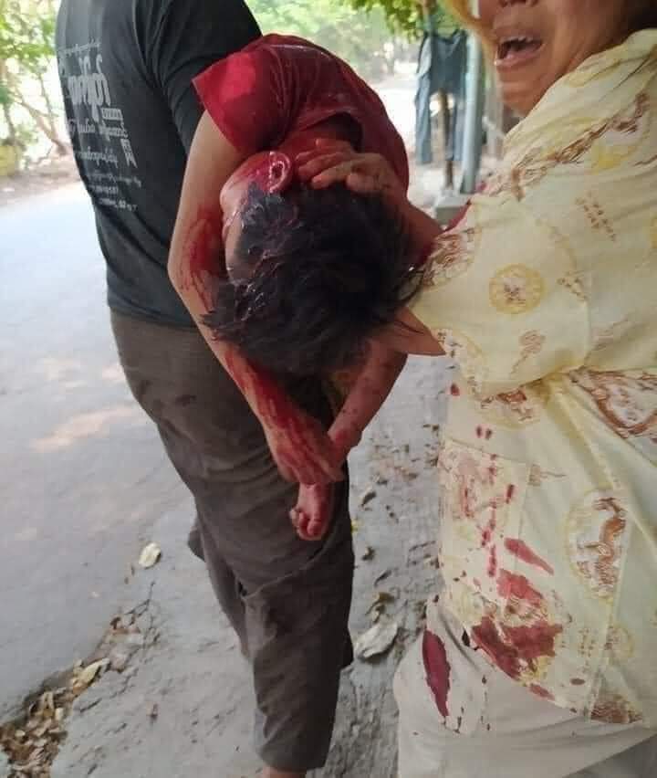 Okka50834703's tweet photo. 5years old child was shot by Myanmar Military! 
More than 60 deaths around Myanmar in one day, today!!! https://t.co/9E3GcxqSMi