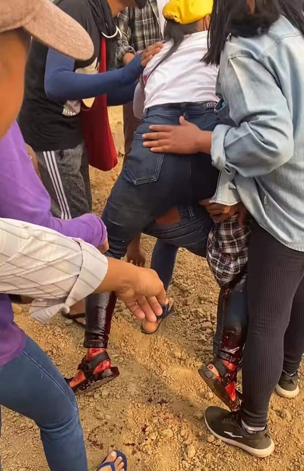 In Hpa Do, Bago;

One people reportedly dead and at least three injured due to violent shooting of military terrorists with live ammunition.
tw // blood
ANTIFASCIST REVOLUTION
#WhatsHappeningInMyanmar  
#AntiFascistRevolution2021 #Mar27Coup