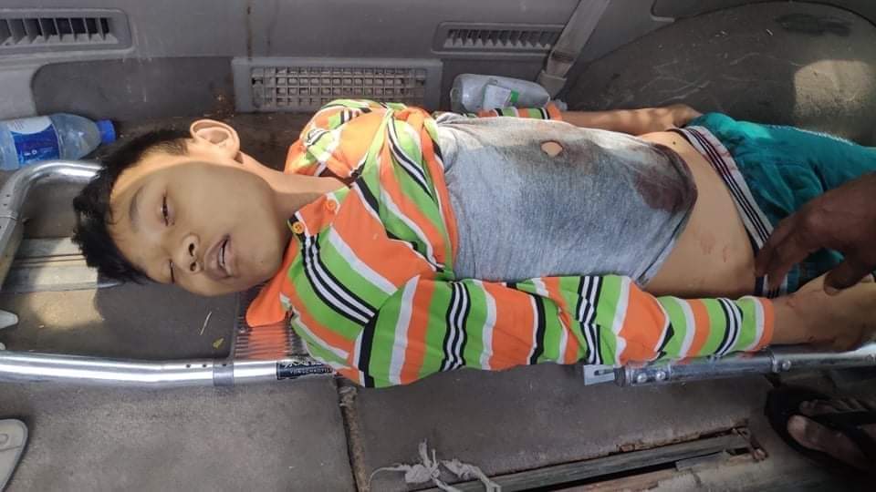 KyawThi32547238's tweet photo. Today, there are more and more serious injuries / deaths of minors across Burma.
We strongly condemn myanmar coup d'tat that brutally shot and killed children. 
#WhatsHappeningInMyanmar 
#savethechildren https://t.co/rRb72eMlIP