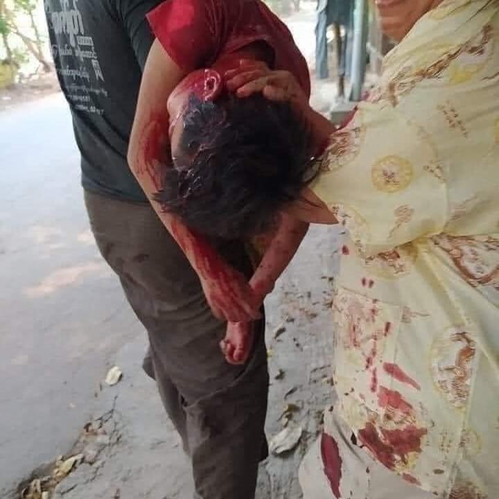 HazelHnin_RBwar's tweet photo. #WhatsHappeningInMyanmar #PleaseHelpOurChildren #Mar27Coup https://t.co/6pdfaA7ahB