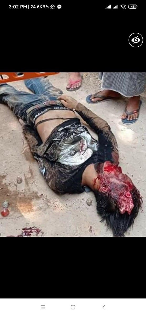 dontknowhera's tweet photo. TW// Blood, Death 

This little girl in #KyikeHto lost her daddy today 😞

The death tolls of civilians (including children) still rising‼️

#AntiFascistRevolution2021 
#WhatsHapppeningInMyanmar 
#Mar27Coup https://t.co/GM05cmJKWW