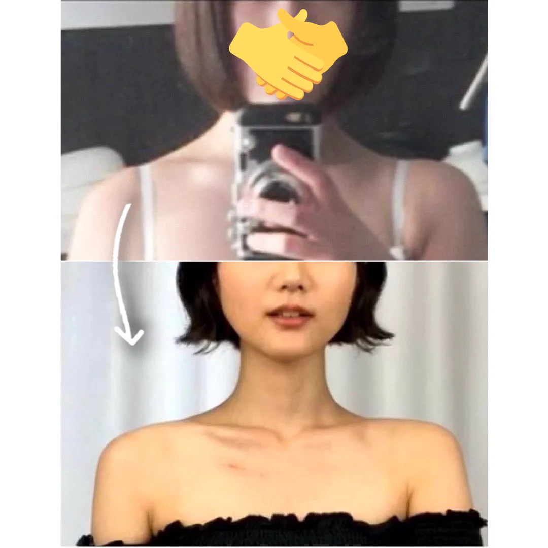 首が太く見えるのはストレートネックのせい？姿勢は意識しよう！