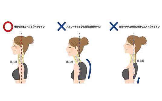 首が太く見えるのはストレートネックのせい？姿勢は意識しよう！
