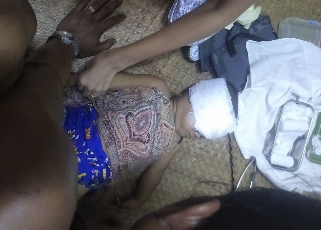tw // sensitive content
In #Yangon, Mayangone Tsp, just a year old girl was shot in the eyes by Military Junta terrorists.
ANTIFASCIST REVOLUTION
#AntiFascistRevolution2021
#Mar27Coup
#WhatsHappeningInMyanmar
#ViolenceAgainstChildren
#SaveChildren
<a href="/SRSGVAC/">@Moviesda isaimini Ibomma Movierulz 2022</a>
<a href="/save_children/">Save the Children International</a>
<a href="/UNICEF/">UNICEF</a>
