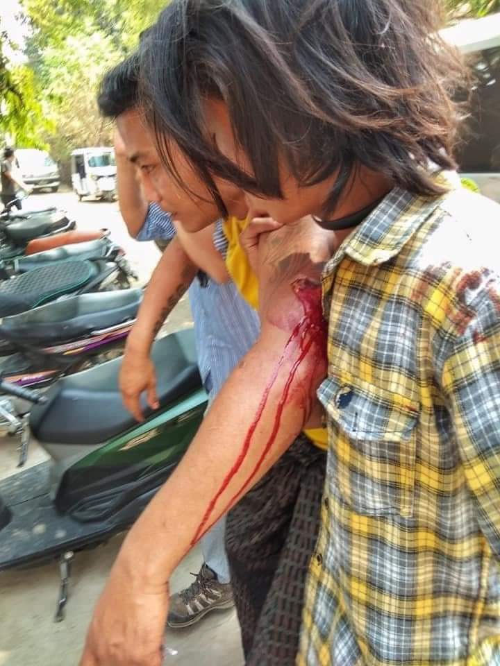 LeiShonn's tweet photo. In Nyaung Oo, 

A tour guide was reportedly shot to dead by military terrorists and other injured with live ammunitions.

ANTIFASCIST REVOLUTION
#WhatsHappeningInMyanmar  
#AntiFascistRevolution2021 #Mar27Coup https://t.co/VmM0moGti6