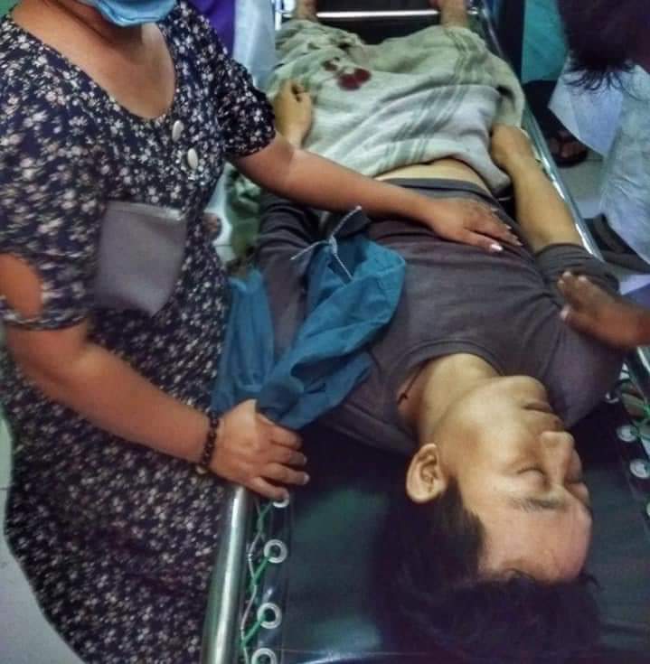 LeiShonn's tweet photo. In Nyaung Oo, 

A tour guide was reportedly shot to dead by military terrorists and other injured with live ammunitions.

ANTIFASCIST REVOLUTION
#WhatsHappeningInMyanmar  
#AntiFascistRevolution2021 #Mar27Coup https://t.co/VmM0moGti6