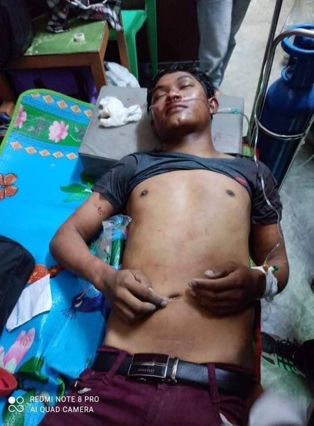 LeiShonn's tweet photo. tw // wound // blood 
In Shwe Bo city, several civilians got shot with live ammunitions by military junta terrorists.
ANTIFASCIST REVOLUTION
#AntiFascistRevolution2021
#Mar27Coup
#WhatsHappeningInMyanmar https://t.co/11Cqf2quw1