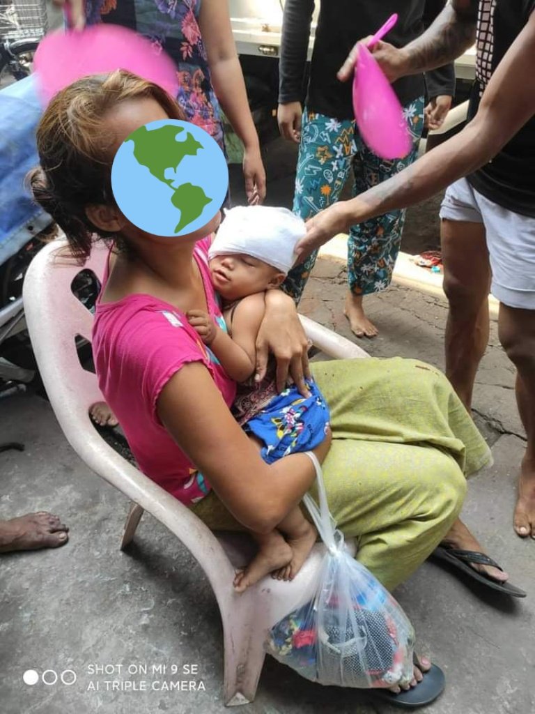b3rry_y's tweet photo. Around 1:43pm in Mayangone Yangon, a one-year old baby who was shot in the eye with a rubber bullet by terrorists!! 
ANTUFASCIST REVOLUTION
#WhatsHappeningInMyanmar 
#Mar27Coup https://t.co/Ad3AJl6oYF
