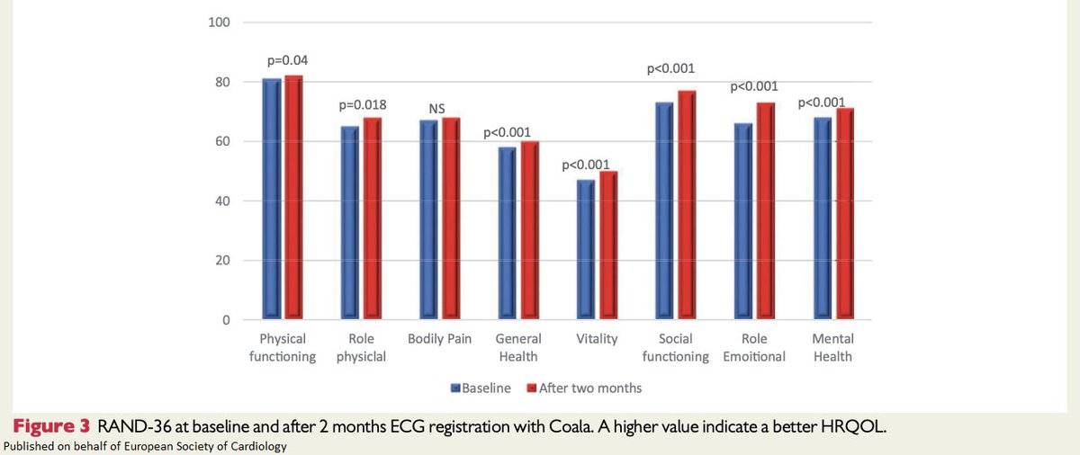 Instant electrocardiogram feedback reduces symptoms caused by palpitations & increases HrQoL academic.oup.com/eurjcn/advance… Listen to the podcast where @JimDwyerMD discusses this article: mediblurb.com/podcast/the-re… @escardio @EditorEJCN @LeonieKlompstra #ACNAP #EJCN #cardiotwitter