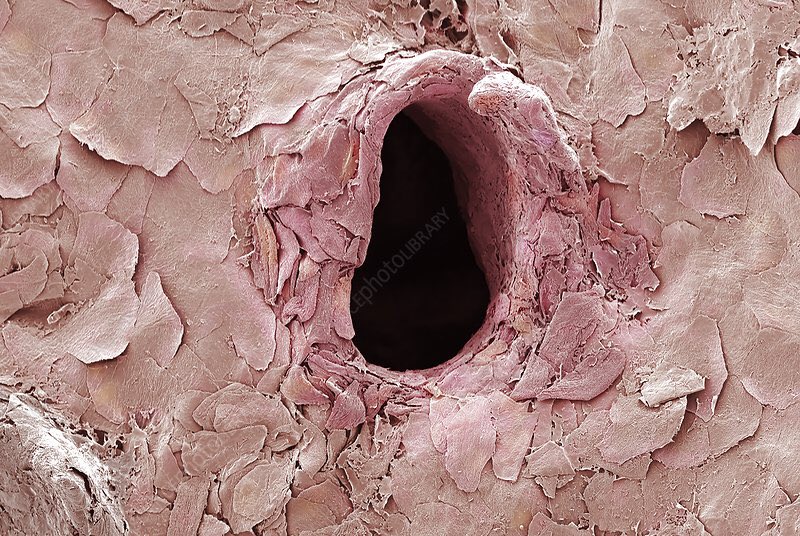 genbankasi's tweet photo. Dövme yaptırmayı mı düşünüyorsunuz ?
⠀⠀⠀⠀⠀⠀⠀⠀⠀⠀⠀⠀
Anne Weston, dövme iğnesinin deride bıraktığı delinmenin görüntüsünü yakaladı.
Via: @sciencephotolibrary
#trypophobia #art #sciart #sciart #sciencephoto #scienceart #medicalart #microscope #tattoo #Holo #cumartesi https://t.co/TQgO6Ig1CP