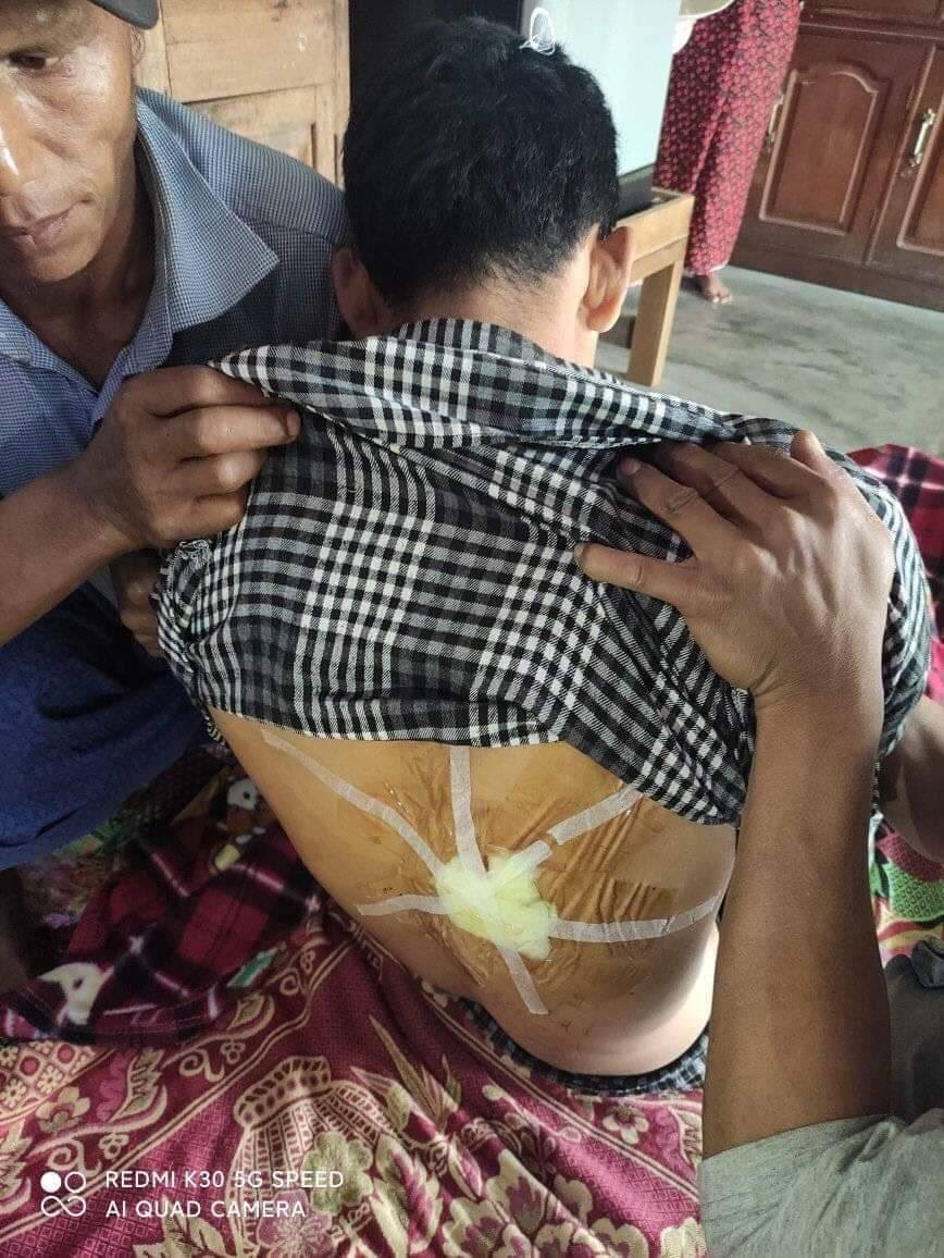 Neew_Wie's tweet photo. Today morning in Hopin City, Kachin State, Military Junta cracked down protesters,  a man was shot dead and four women were abducted.
ANTIFASCIST REVOLUTION
#AntiFascistRevolution2021
#Mar27Coup
#WhatsHappeningInMyanmar https://t.co/w5kk7Meom1