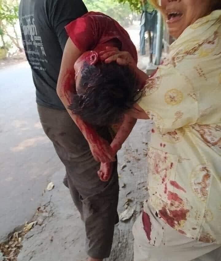 ZuneJu's tweet photo. Please, don't shoot the children.
Please, they are just children.
@UN_HRC @UNICEF @freya_cole @USEmbassyBurma @ukinmyanmar 
#Save_the_children 
#WhatsHappeningInMyanmar #Mar27Coup #MilkteaAliance https://t.co/HIrkalBuYJ