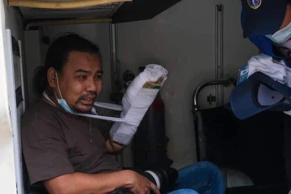 MhonePoe's tweet photo. A reporter from Mandalay was shot with live ammo n the bullet  penetrated through his hand. According to news, At least 10 have been killed only in Mandalay on Mar 27.

ANTIFASCIST REVOLUTION

#AntiFascistRevolution2021
#Mar27Coup
#WhatsHappeningInMyanmar https://t.co/KdGpA48Weu