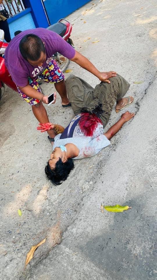 ida_kyp's tweet photo. Mawlamyine, Mon State:

A protester injured as Terrorists (#Myanmar security forces) use live ammunition to disperse the protesters. 

#WhatsHappeningInMyanmar #AntiFascistRevolution2021 #Mar27Coup #MilkTeaAlliance https://t.co/4qhD8c7CX9