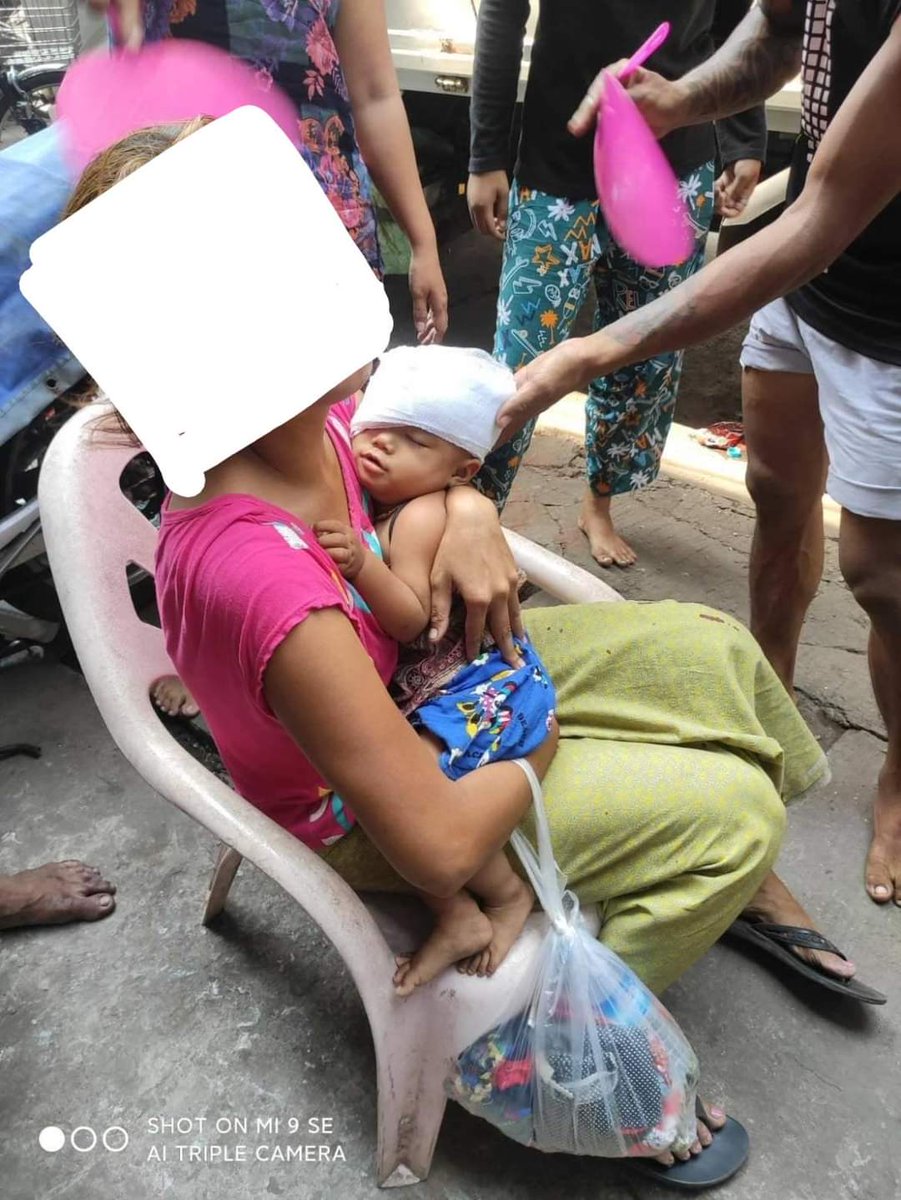 YadanarYoon's tweet photo. One year old baby shot in the eye with rubber bullet in Myanmar today by Military Junta(SAC). He was just playing on the platform at Tamine Market station. ANTIFASCIST REVOLUTION #AntiFascistRevolution2021 #WhatsHappeningInMyanmar #Mar27Coup https://t.co/rT6tMGG1Jf