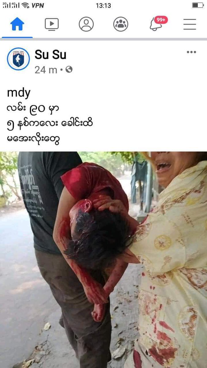 PhwayPh88637259's tweet photo. Today on TatMadaw Day.
A-one-year-old child was shot in the eye by Myanmar Military.
5-year-old &amp; 13-year-old were shot to death by Myanmar Military.
Nobody deserves to die this young..
This breaks my heart .. 💔
#WhatsHappeningInMyanmar
#CrimesAgainstHumanity
#March27 https://t.co/5pXrlL6Lzr