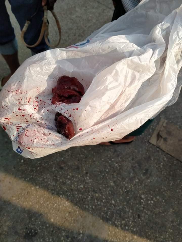 tw // blood 
A man was shot in #Hlaing,ThanLan street, Yangon. Notsure he was dead or not and one of his internal organ was found on the ground. 
ANTIFASCIST REVOLUTION

#AntiFascistRevolution2021
#WhatsHappeningInMyanmar #Mar27Coup