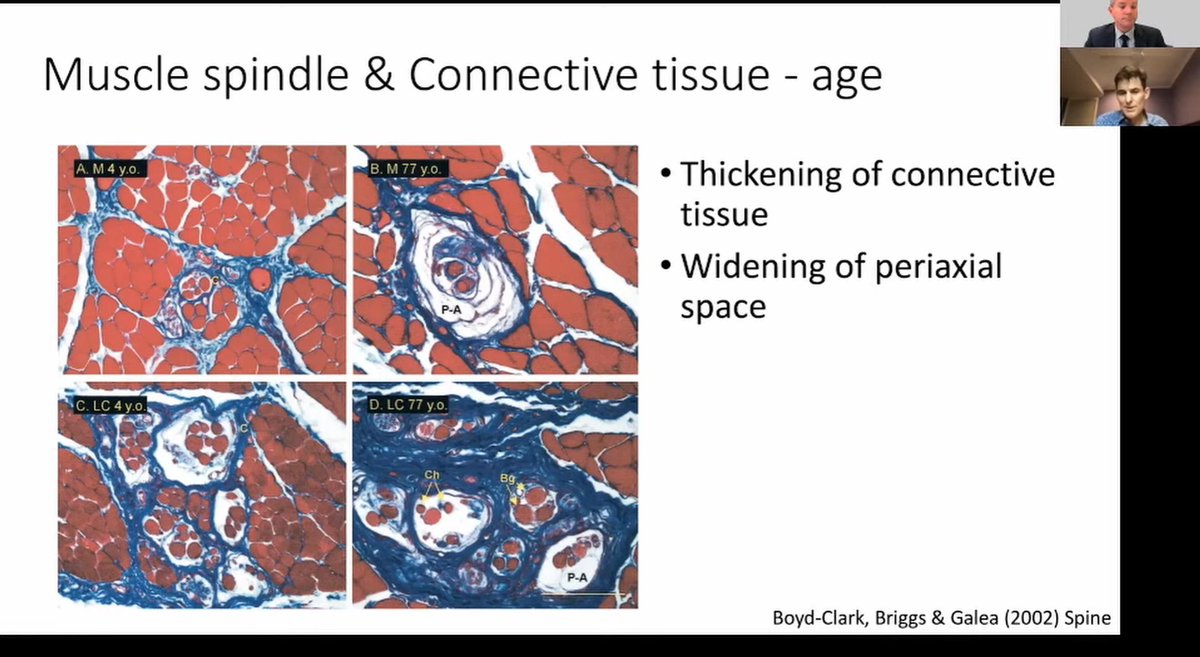Cool talk from <a href="/paulwhodges/">Paul Hodges</a> suggesting that, as with age, muscle spindles become more fibrotic following injury. What are the implications for balance and control #connect2021