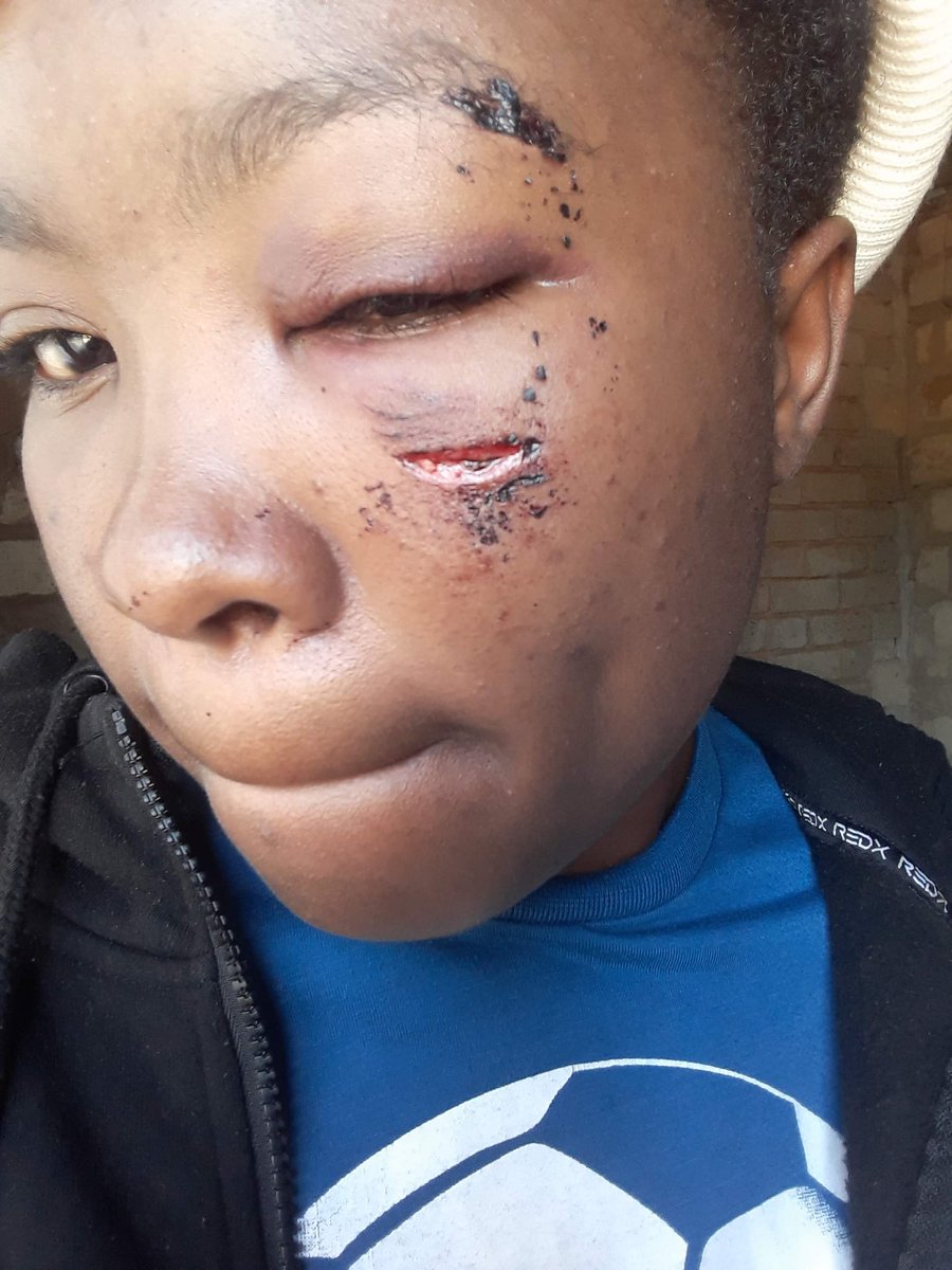 tau_botshelo's tweet photo. #SAPS #sapsGP #sapsFS I'm not happy how things are done at Amalia Police https://t.co/Asv8INDenA cousin was attacked by a guy last night she went to the police station to open a case instead of helping her they wanted to hear his side of his story, they even bribed her with R350 https://t.co/mzh3CfRaxK