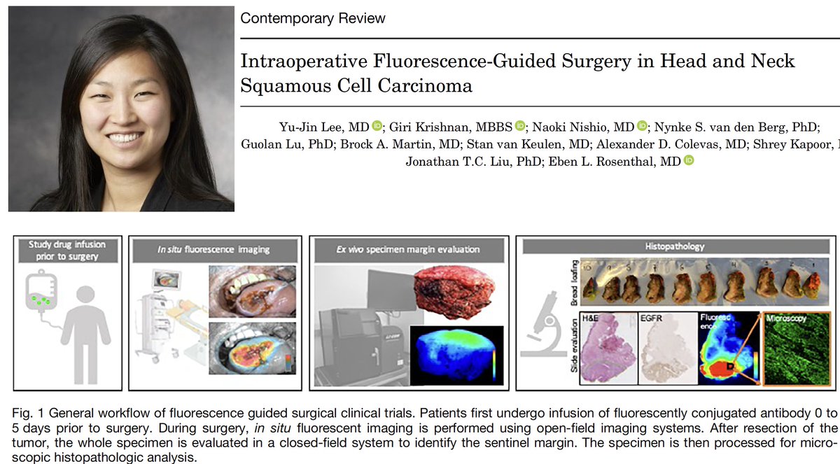 Congratulations <a href="/yjlee/">Yu-Jin Lee</a> <a href="/StanfordHNS/">StanfordHNSurgery</a> for a great review of "Intraoperative Fluorescence-Guided Surgery in Head &amp; Neck SCC" published online this week in the #Laryngoscope <a href="/Triological/">The Triological Society</a> #hnsm