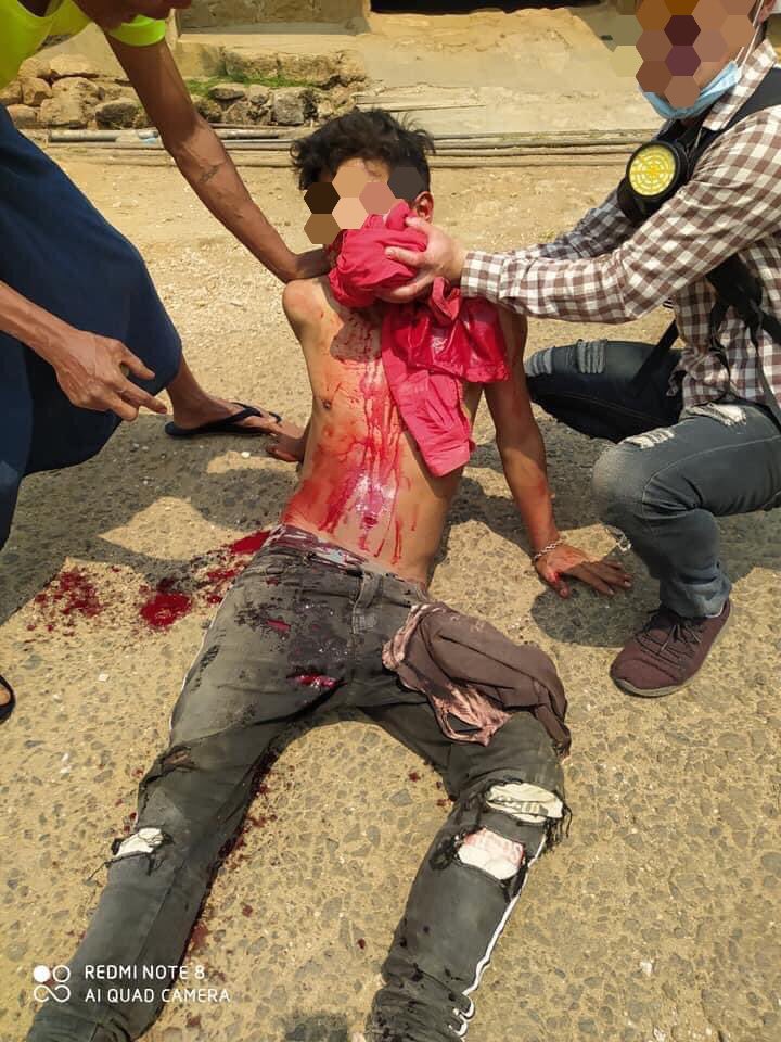 hannayuri_twt's tweet photo. tw // blood
Military terrorists violently dispersed peaceful strikes in #Mogok. Two person were shot DEAD, 1 in throat &amp; 1 in the abdomen. More than 15 people were injured from live ammunitions.
ANTIFASCIST REVOLUTION
#AntiFascistRevolution2021
#Mar27Coup
#WhatsHappeningInMyanmar https://t.co/YIvgdG5osb