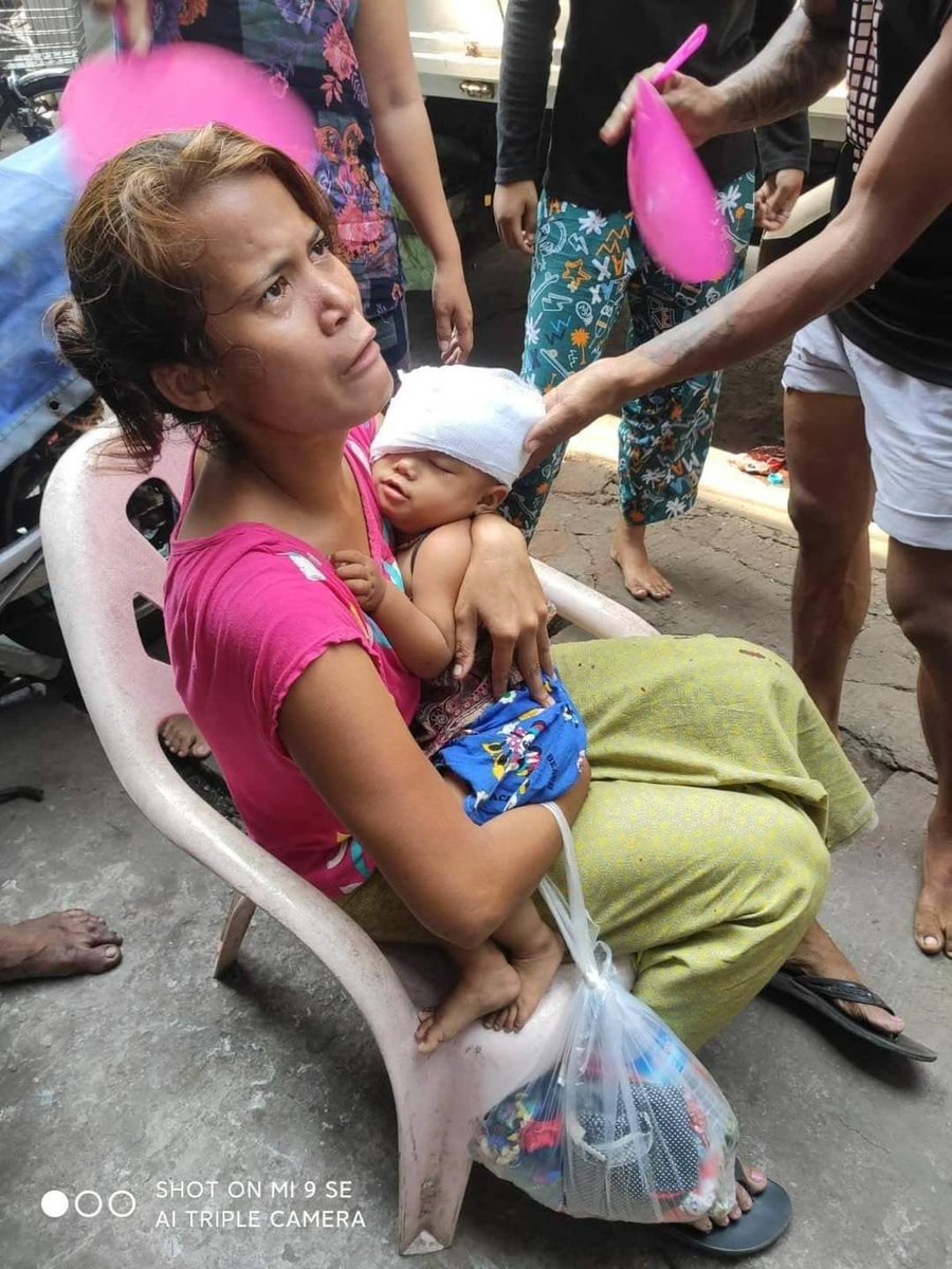 อ่องลายไม่ใช่คน สั่งทหารยิงประชาชนจนกระสุนยางโดนเด็ก 1 ขวบ จนอาจตาบอด เหตุเกิดที่ย่างกุ้งซึ่งวันนี้ทั้งวันมีการใช้กำลังล่าประชาชนอย่างหนัก คนตายทั้งประเทศจ่อทะลุ 100 คน
#WhatHappeningInMyanmar #SaveMyanmar #Mar27Coup