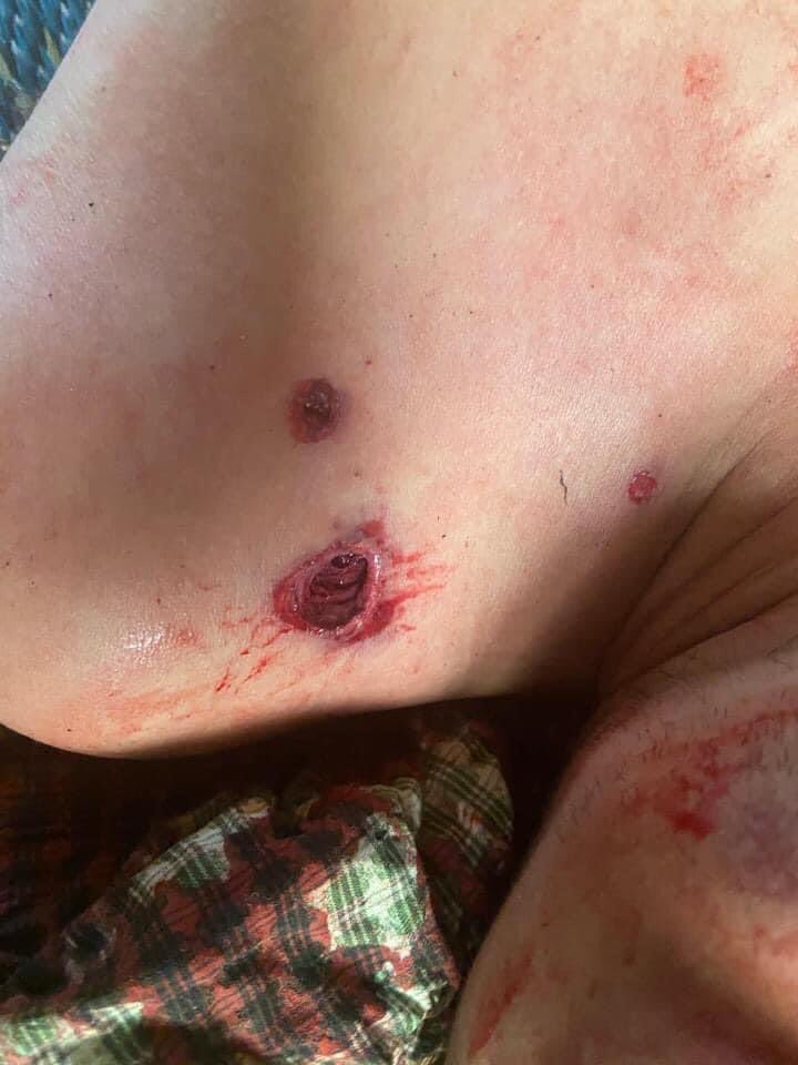 hannayuri_twt's tweet photo. tw // graphic content // blood
Military terrorists continually firing at #Mogok west &amp; total 7 person were injured from live ammunitions this evening.
1 female was shot DEAD in head
2 were shot in the chest and now in critical conditions.
#Mar27Coup
#WhatsHappeningInMyanmar https://t.co/guivVsYa0g