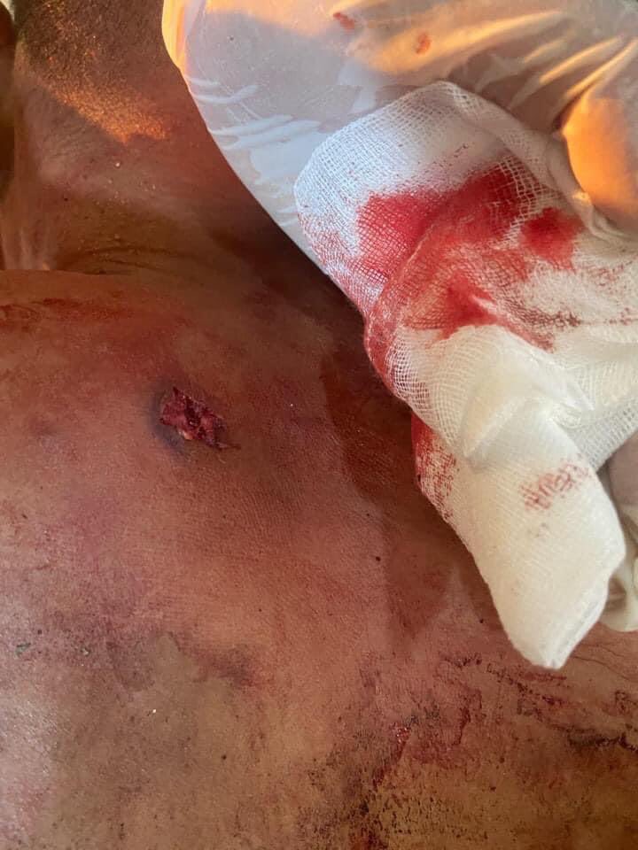 hannayuri_twt's tweet photo. tw // graphic content // blood
Military terrorists continually firing at #Mogok west &amp; total 7 person were injured from live ammunitions this evening.
1 female was shot DEAD in head
2 were shot in the chest and now in critical conditions.
#Mar27Coup
#WhatsHappeningInMyanmar https://t.co/guivVsYa0g