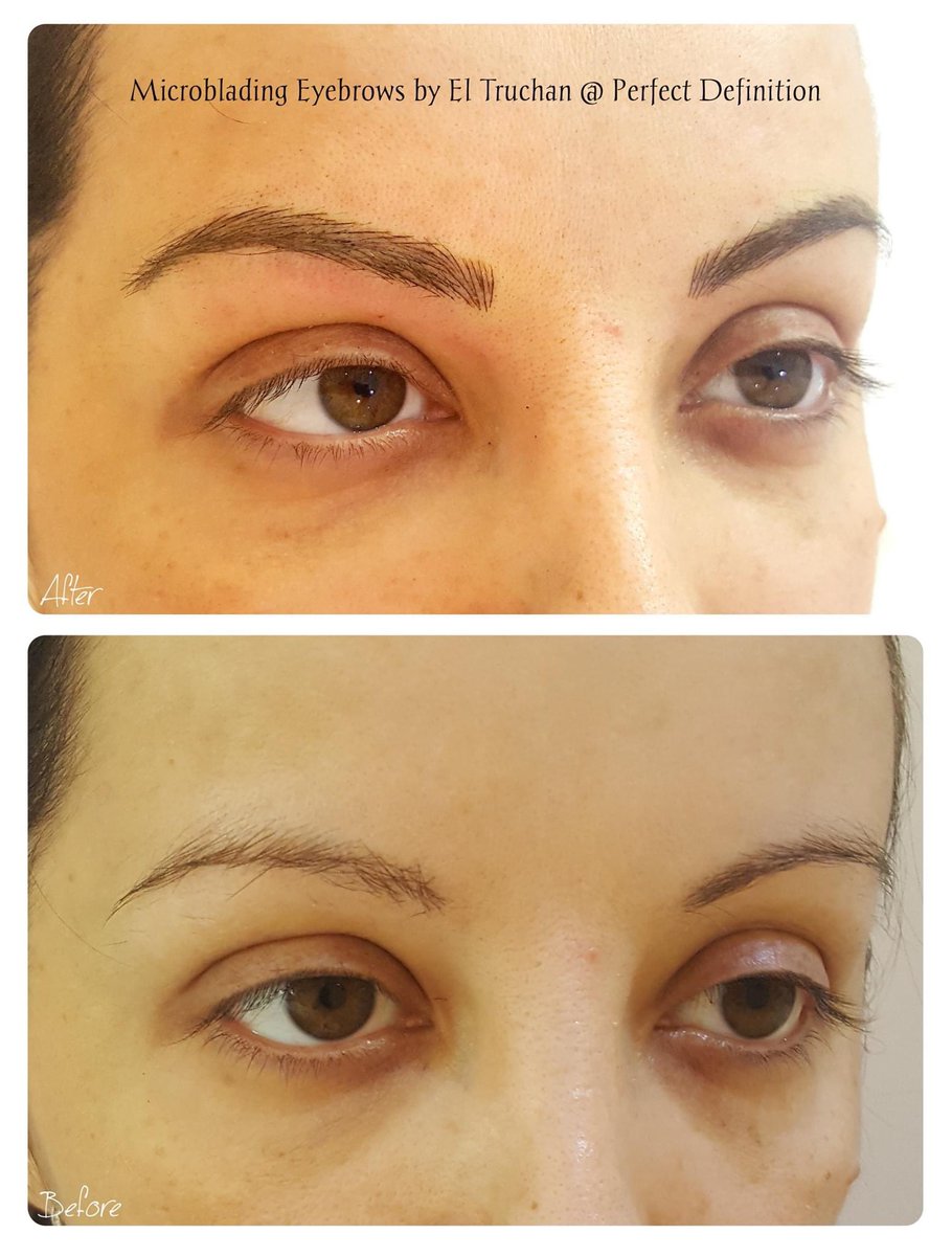 ElTruchan's tweet image. Microblading Eyebrows by El Truchan @ Perfect Definition

#permanenteyebrowsshape #permanenteyebrowtattoo #digitalmicroblading #hairstrokes #browqueen #browformation #nanoblading #nano-blading #microfeathering #microshading