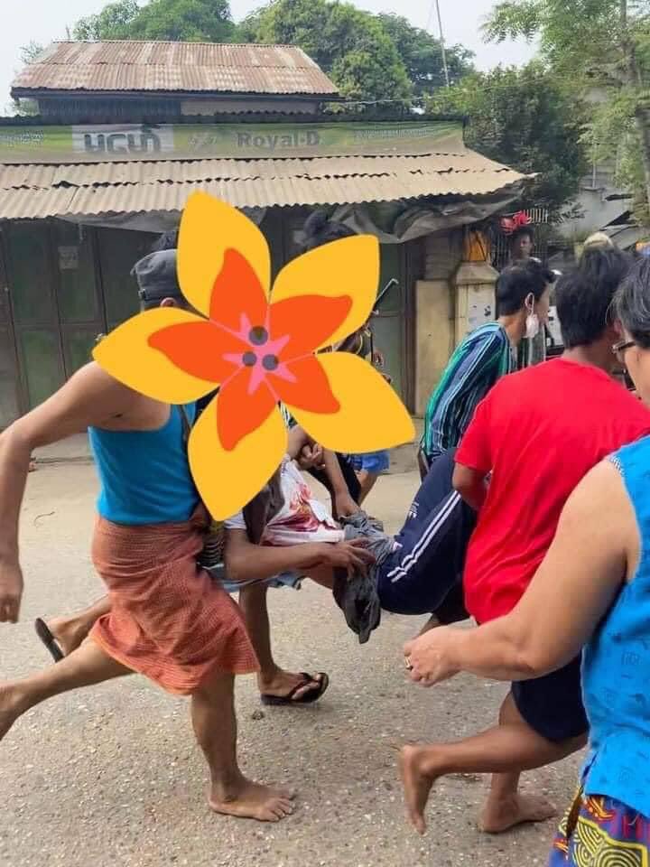 Tw // blood , death
Two were shot and one was killed in Insein, Ywar Ma this morning.
Violence is seen everywhere today.
ANTIFASCIST REVOLUTION

#AntiFascistRevolution2021
#Mar27Coup
#WhatsHappeningInMyanmar