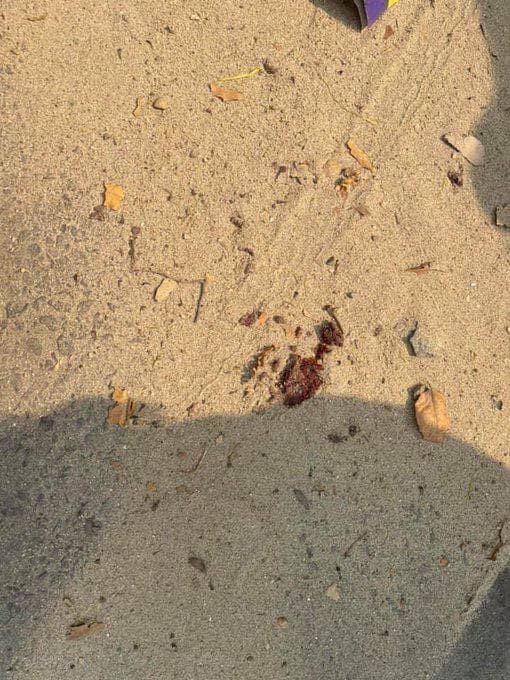 Tw // blood 
In Mandalay, One was headshot to death and body was taken by the TERRORISTS. The terrorists covered the pieces of skull &amp; blood with sand.
ANTIFASCIST REVOLUTION

#AntiFascistRevolution2021
#Mar27Coup
#WhatsHappeningInMyanmar