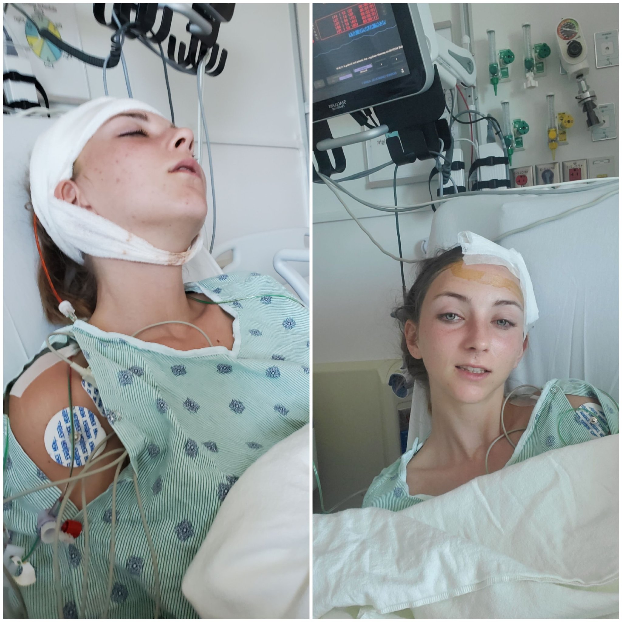 Wasn't sure we was going to share these. But im sure her friends and fans want to see her. From yesterday, she's a fighter and is doing great for having brain surgery. Let's keep praying. #fightformacymeadows #welovemacymeadows #prayformacymeadows https://t.co/xdjWKfGlAM