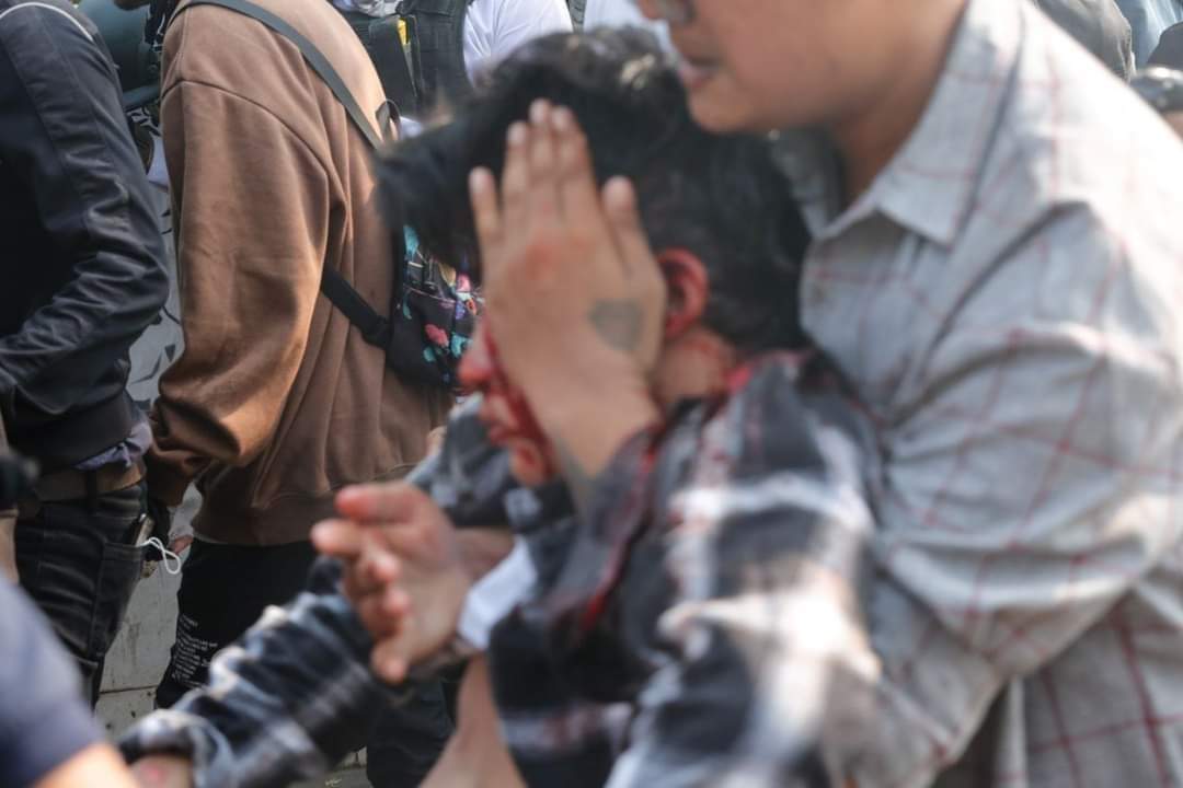 AyeChannMinn's tweet photo. Tw // death 
Mawlamyine(Dite-Wun Kwin) 
1 death &amp; more than 10 people are Injured. Military Terrorists slaughtering at least 100 civilians only in single day(Day of Shame) 
ANTIFASCIST REVOLUTION

#AntiFascistRevolution2021
#Mar27Coup
#WhatsHappeningInMyanmar https://t.co/vIXTK2Yn7t