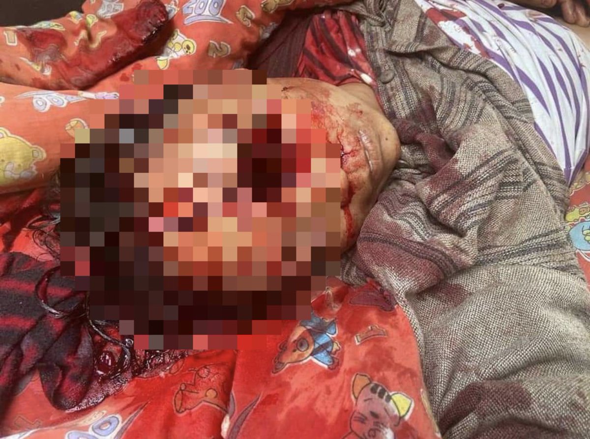 shafiur's tweet photo. #mar27coup Mogok

SEVENTEEN YEAR OLD youth shot dead as the SAC JUNTA dine and wine in Naypyidaw 

#WhatsHappeningInMyanmar #CrimesAgainstChildren https://t.co/dPf3tAIHCO