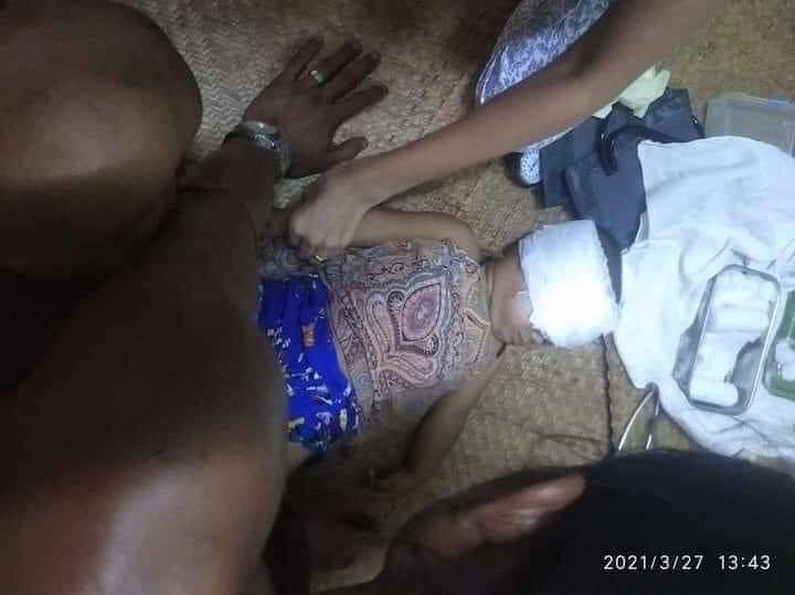 DanielS75737205's tweet photo. 27.Mar.2021 
Speechless inhumanity of Junta Terrorists, just over one-year-old child was shot at eye by rubber bullet in Mayangone, Yangon. 
Please ACT NOW R2P in Myanmar. ANTIFASCIST REVOLUTION
 #WhatsHappeningInMyanmar
 #Mar27Coup
#R2PNowForMyanmar #CrimeAgainstHumanity https://t.co/ltqHdxYZre