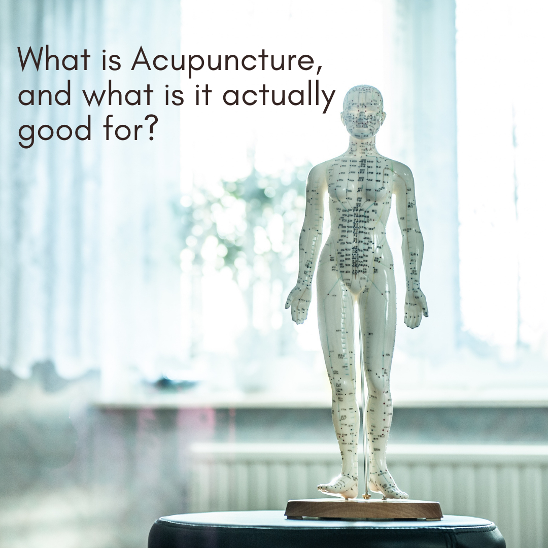 KianiNaturopath's tweet photo. Acupuncture involves the insertion of extremely thin needles to specific locations of the body to benefit a local area or the whole body. So, what is it good for? 

Short answer: MANY THINGS!

Long answer: There are Eastern vs. Western styles of acupuncture (think traditional Chi https://t.co/Wa5dcbsg15