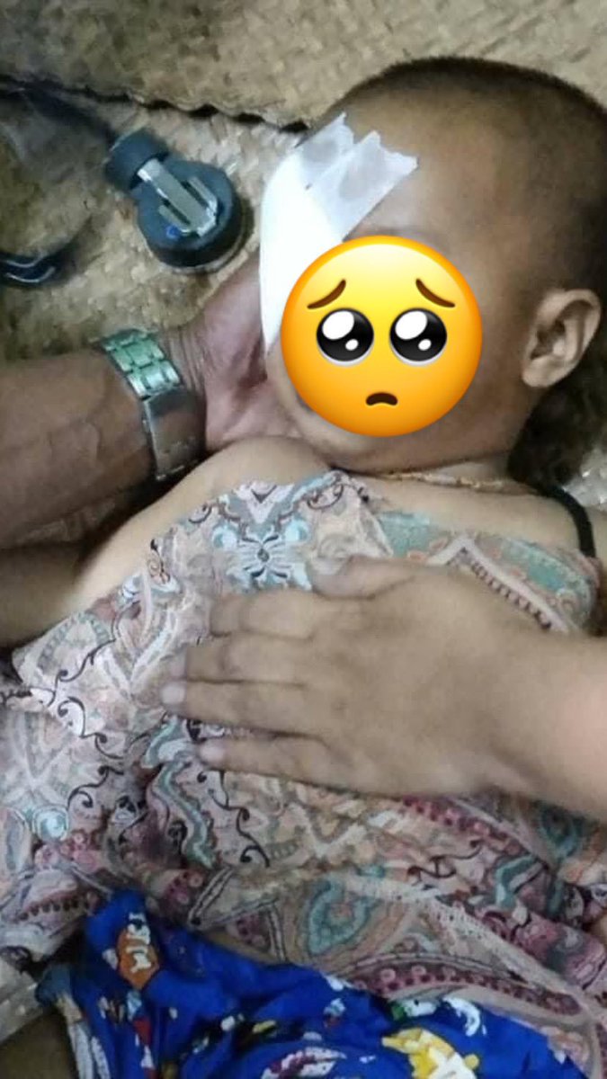 Hyejin269's tweet photo. One year old baby shot in the eye with rubber bullet in Myanmar today by Military Junta(SAC). He was just playing on the platform at Tamine Market station. 

ANTIFASCIST REVOLUTION #WhatsHappeningInMyanmar #Mar27Coup
#CrimesAgainstChildren https://t.co/amhNUQJ2WD