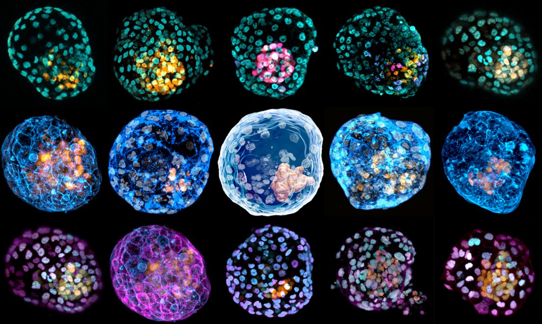 S_Mastenbroek's tweet photo. Het is wetenschappers gelukt de ontwikkeling van embryo's na te bootsen. De gevolgen op lange termijn kunnen groot zijn. https://t.co/I1K3ZGpy8q  via @trouw @amsterdamumc https://t.co/O6uy9V2NQr