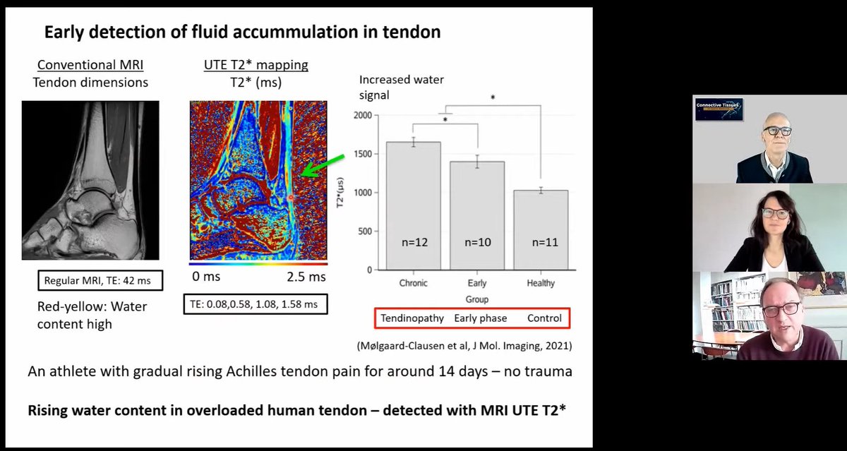 Beautiful images showing early water coming into the intrafascicular space in tendinopathy