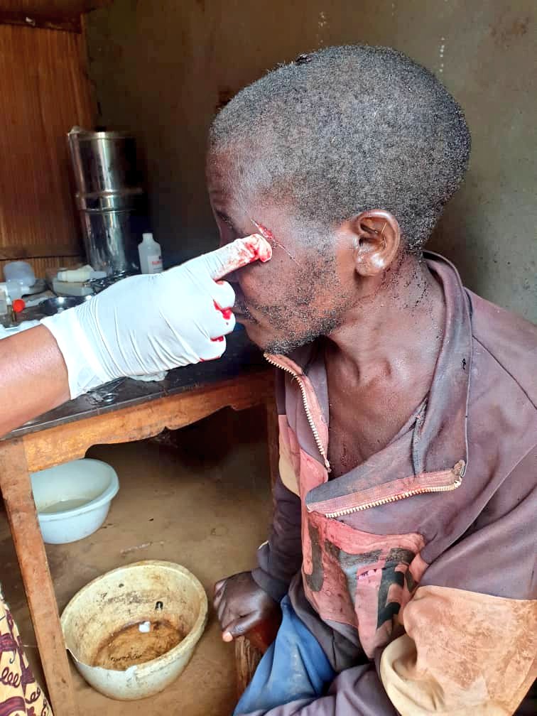 MaishaRdc's tweet photo. #ITURI_RDC: 3 personne ont été sauvagement blessées par les miliciens #CODECO. Elles sont au centre de santé #MBIDJO.(27/03/021). Des petits problèmes entre citoyens, certains utilisent aussi leur influence s'ils ont connaissance avec ces miliciens.
@MinDelegue @JeanBamanisa https://t.co/uEyPQgmMH6