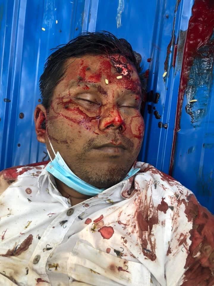 ShunnleiK's tweet photo. These are the lowest dead bodies.  Families of survivors are known to acquaintances

  #voiceofmyanmar #VOM #Mandalay #March27Coup https://t.co/mdauHubQYs