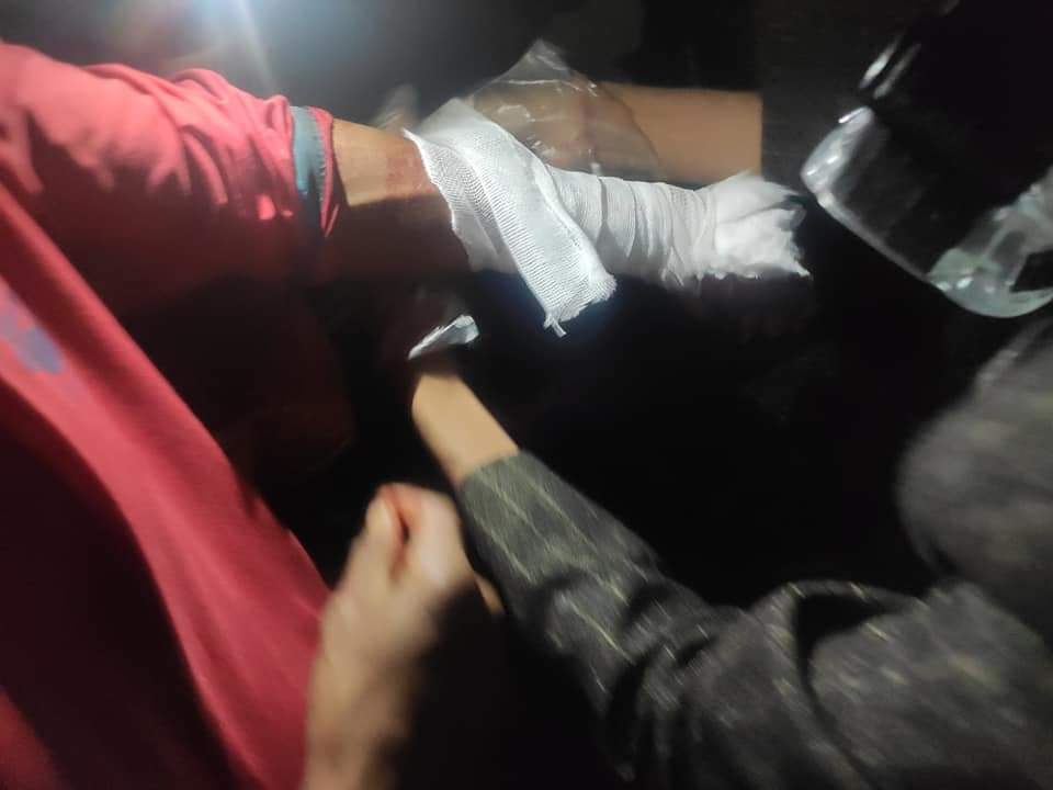 SaveMM99's tweet photo. Tw//blood
According to Shan News Agency,5 Civillians have been shot and injured in #Taunggyi tonight as Military's sponsored Terrorists are continuously shooting tonight.
ANTIFASCIST REVOLUTION
#AntiFascistRevolution2021
#Mar27Coup
#WhatsHappeningInMyanmarsave https://t.co/Zm4HdvfN9E