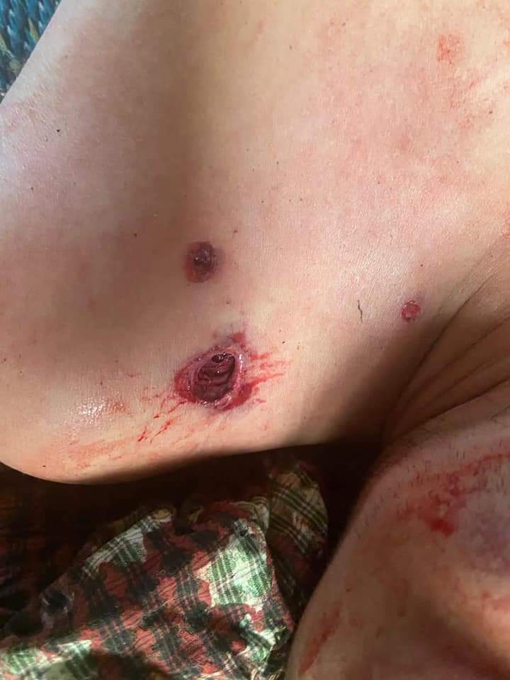 MaryKT_'s tweet photo. TW//BLOOD, DEAD
Mogok:
A civilian shot dead in late-night shooting by security force of Military Junta in the westside of Mogok
#WhatsHappeningInMyanmarNow
#AntiFacistRevolution2021
#Mar27Coup @UN_HRC @CIJ_ICJ @ICC @freya_cole @MayWongCNA https://t.co/mTyG1HW0sZ